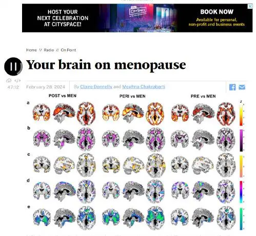 Screenshot of NPR’s “Your Brain on Menopause” podcast episode with brain scan visuals comparing hormonal stages, used in Chronic Health Wisdom’s menopause article